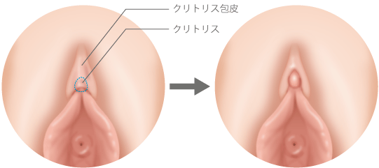 アパホテル〈仙台勾当台公園〉のアルバイト・パート求人情報 | JOBLIST[ジョブリスト]｜全国のアルバイト求人情報サイト