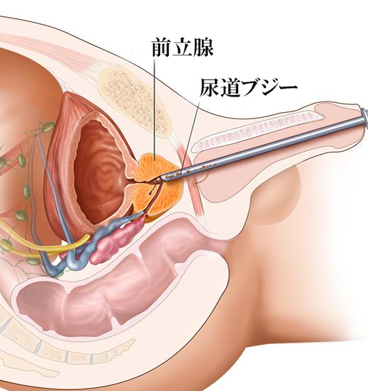 Fetishi-SM 七緒BLOG -