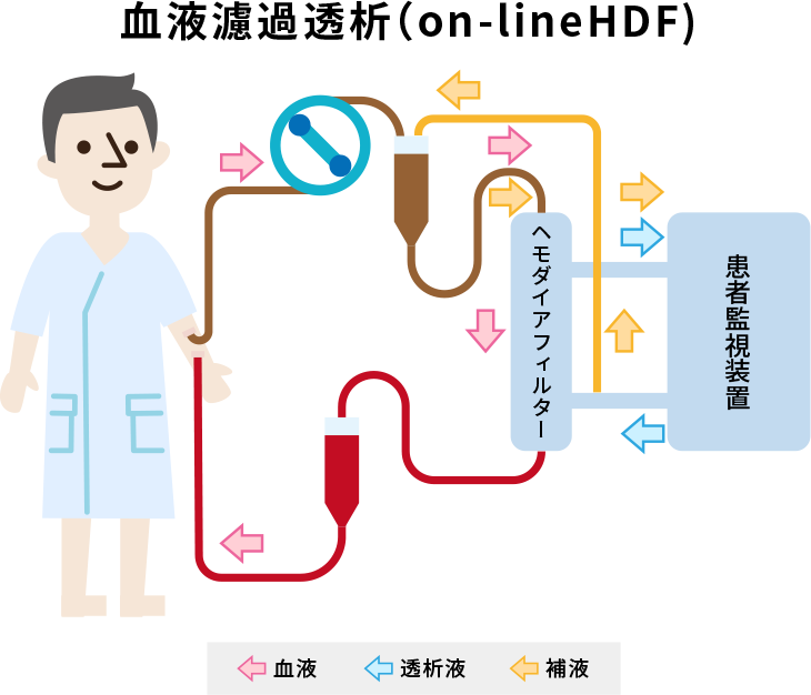知っておくべきあらゆる種類の濾過技術 - HENGKO