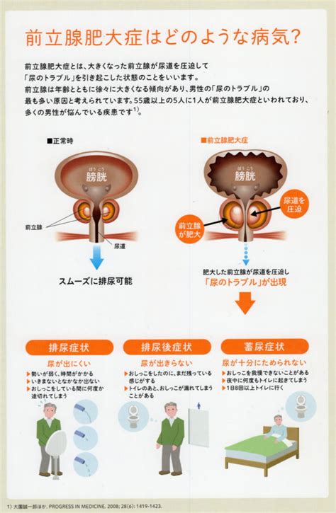 Amazon | ペニスプラグ ステンレス