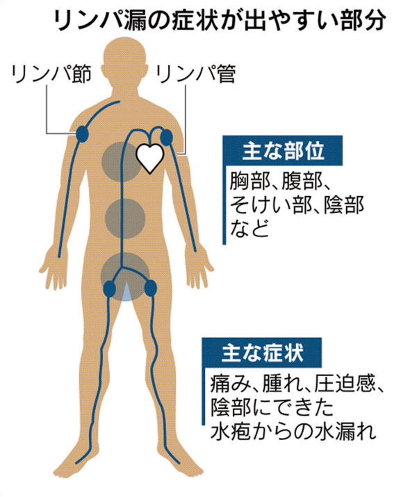 写真・画像】２６２号 キラキラ美人部more vol.30 セルフリンパマッサージでむくみ解消！ |