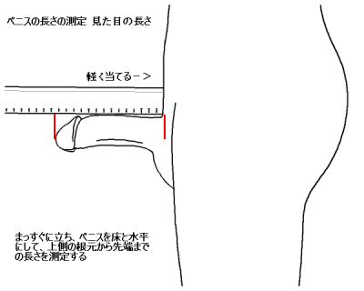 短小包茎をチェックしよう！日本人の平均サイズや測定方法、治療についても | 包茎手術のノーストクリニック【公式】