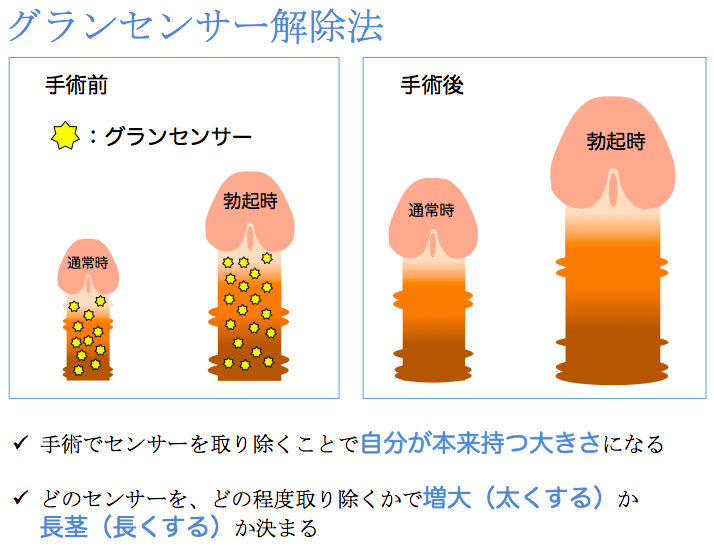 ペニはか～る|アダルトグッズや大人のおもちゃ、玩具の通販ショップのNLS