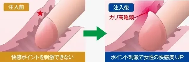 短小包茎をチェックしよう！日本人の平均サイズや測定方法、治療についても | 包茎手術のノーストクリニック【公式】