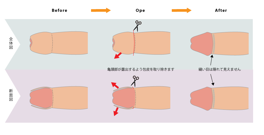 遅漏」の人気タグ記事一覧｜note ――つくる、つながる、とどける。