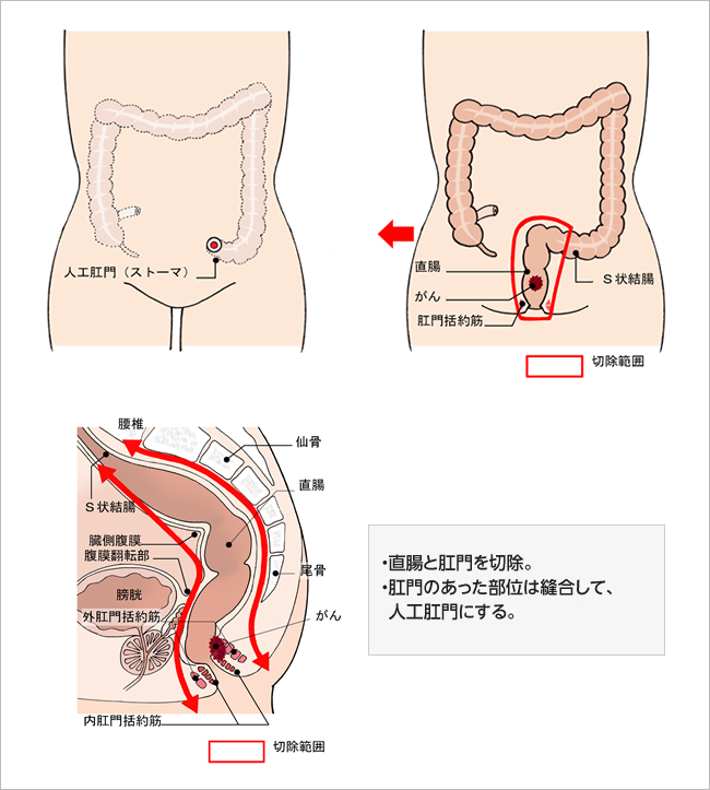 S状結腸を超えよう！ | 電マ好き