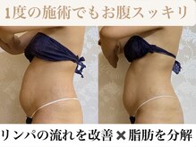 ピュアボディ(Pure Body)姫路本店のエステ・エステティシャン(正社員/兵庫県)求人・転職・募集情報【ジョブノート】