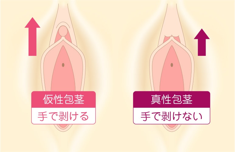 クリストスがどこか分かりません教えてください。 - 凄く小さいから処女の