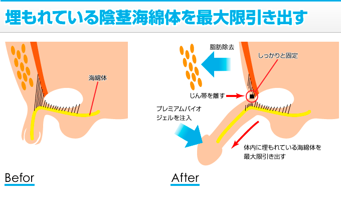 日本人平均は13.56cm？スマホで自分に合ったTENGAが確認できる - 週刊アスキー