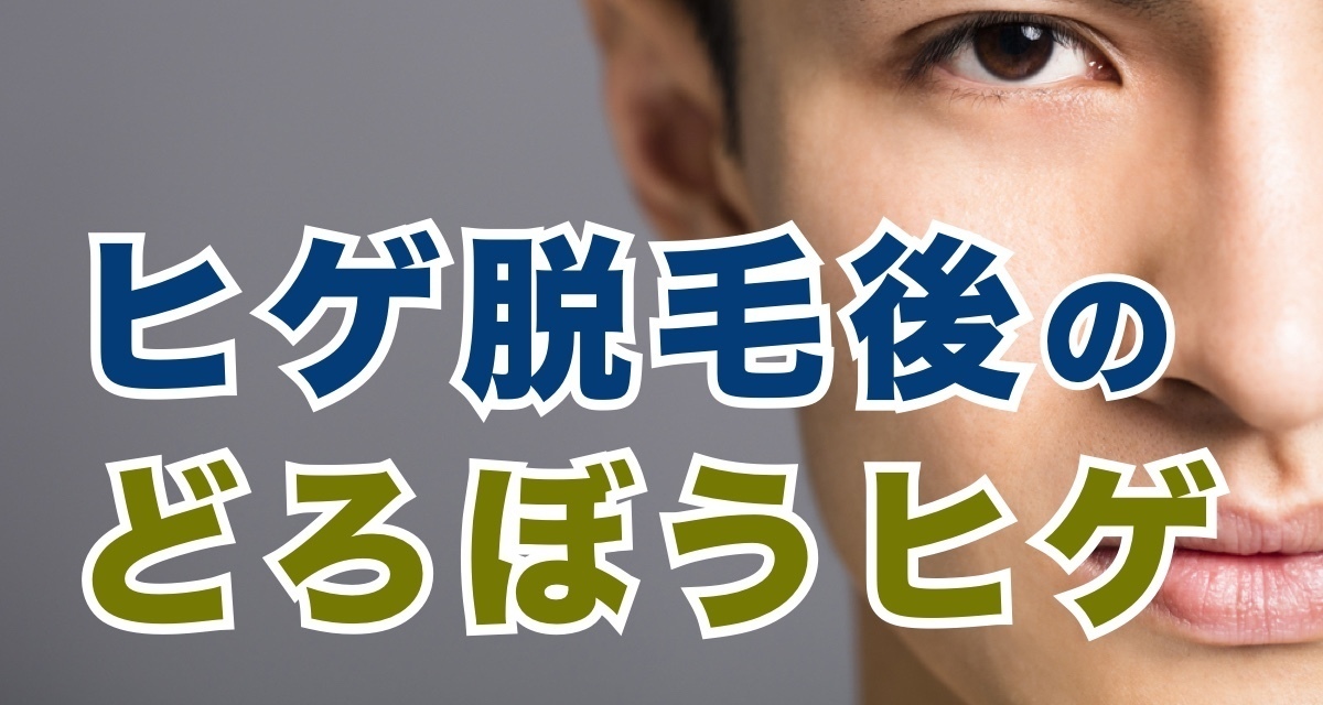 危険】髭の白髪を抜くのはNG！今すぐできる若さを保つ方法2選 | ヒゲ脱毛ガイド