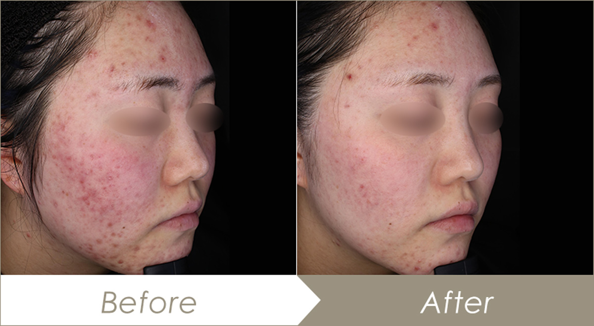 AI画像高画質化サイト - 画像の解像度を上げて画質を良くする無料アプリCanva キャンバ