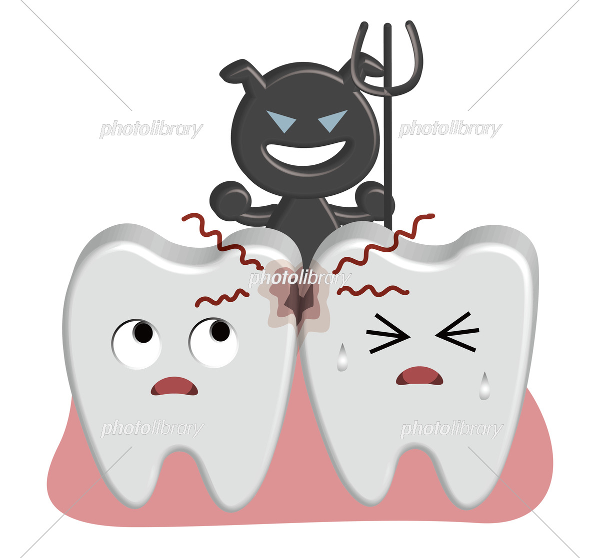 虫歯菌が歯を痛くしているイメージのイラストイラスト無料・かわいいテンプレート