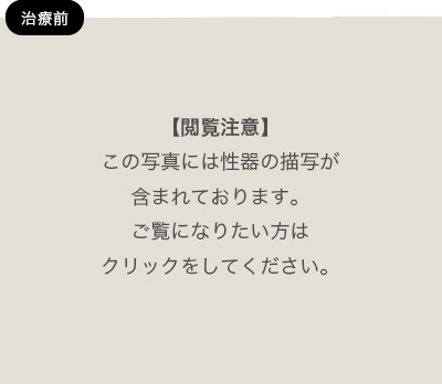 亀頭を大きくして「カリ高チンコ」になる方法【全部、自力でやれます】