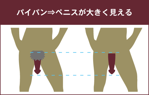 これが男子のリアルな意見！ ハイジニーナ・パイパン は好き？嫌い？女性にして欲しいアンダーヘアの形は！？「女性のアンダーヘアに対する男性の意識調査」を実施｜株式会社うちなーうぇぶのプレスリリース