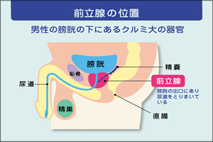 前立腺肥大症│春日井市の前立腺肥大症の治療ならみちかぜクリニック