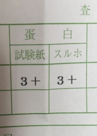 オトコの科学】尿検査前日にオナニーしてもバレない方法８選 | STERON