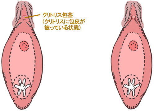 シリーズ「クリトリスの皮を剥いて豆いぢり」の画像40枚をまとめてみました - エロプル