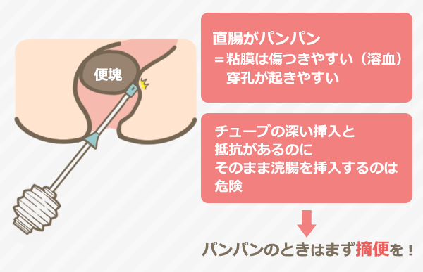 意外と怖い「グリセリン浣腸」、直腸穿孔や溶血など起こり得るトラブル8つ｜排便ケアを極める（2） | 看護roo![カンゴルー]