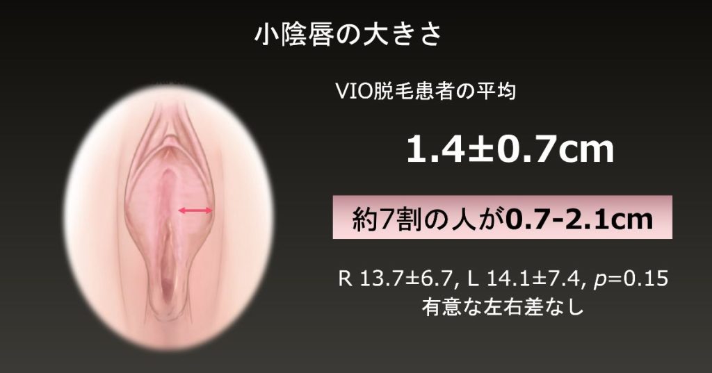 女性のための巨大な舌のディルドのバイブレーターのための巨大な吸い殻の口唇舐めクリトリスは大人のためのオナニーのエロティックなおもちゃを刺激するY200616を￥4,788  | DHgate