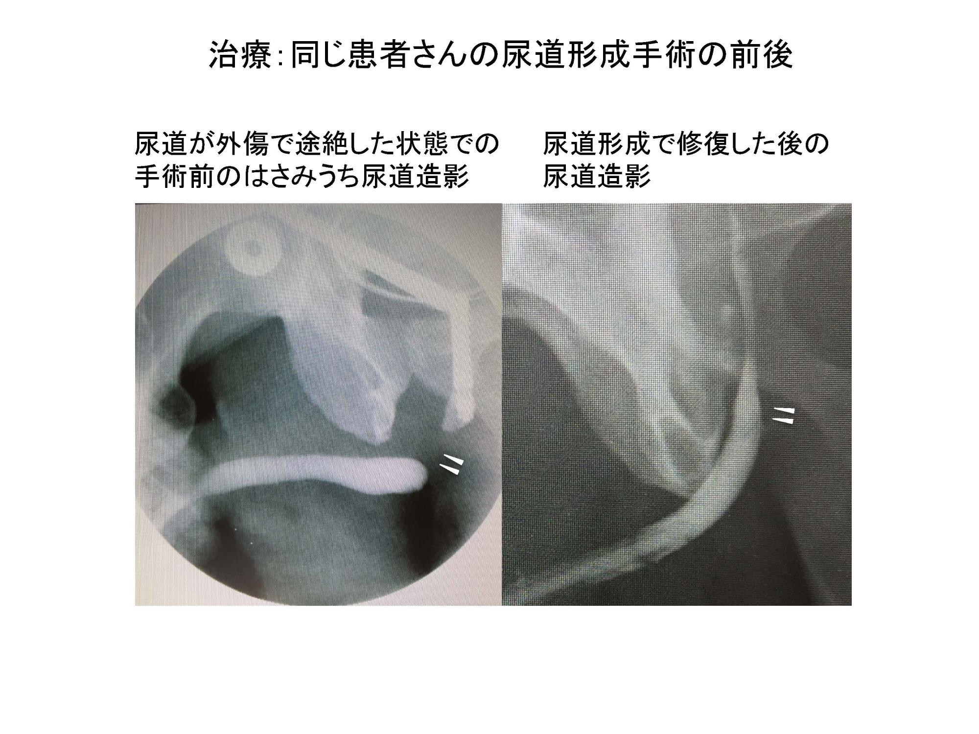 尿道プレイ・尿道責め