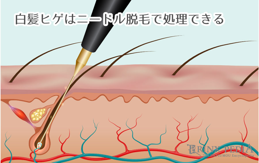 危険】髭の白髪を抜くのはNG！今すぐできる若さを保つ方法2選 | ヒゲ脱毛ガイド