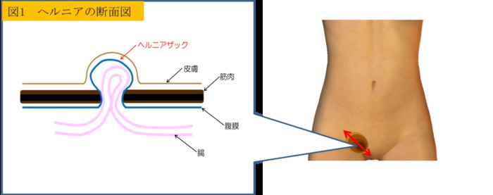 楽天市場】鼠径部 締め付けない ショーツ