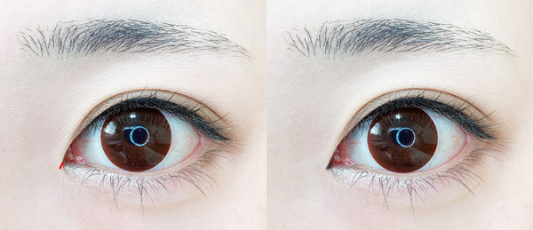 目頭切開ラインの書き方✾離れ目解消