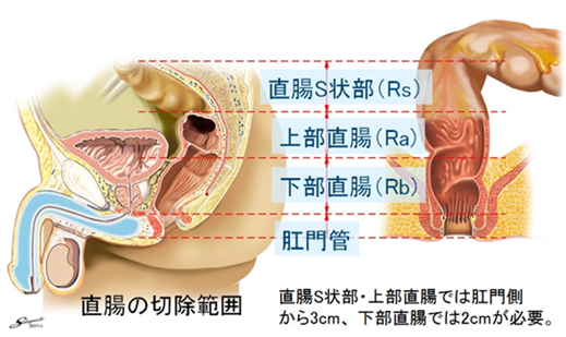 s字結腸 bl作品 bl情報サイト ちるちる