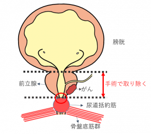 前立腺肥大症 | 中野駅前ごんどう泌尿器科