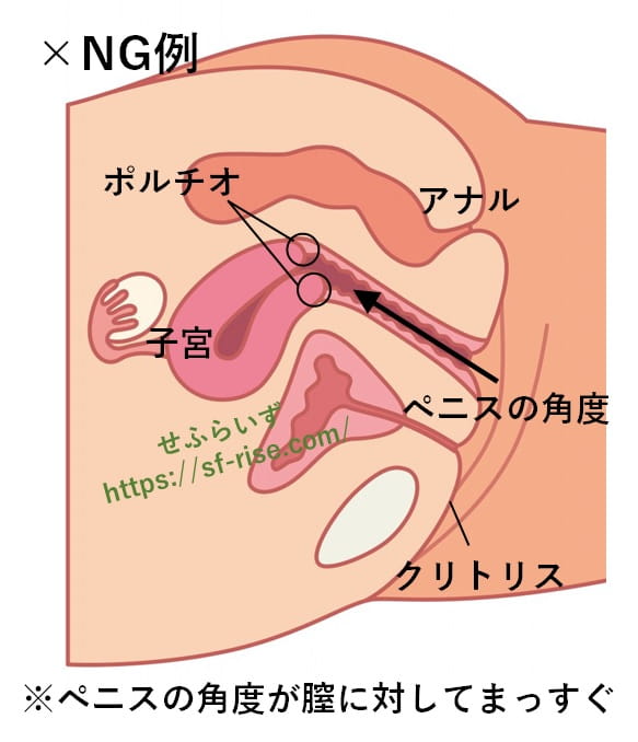 性生活に必要なモノ 後背位の座位