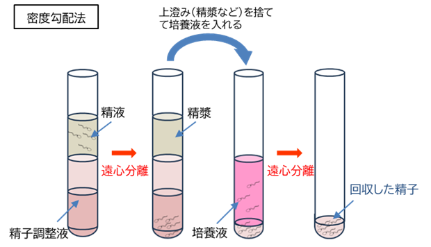 新しい精子調整法 | 暮里レディースクリニック｜日暮里レディースクリニックブログ