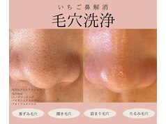 高槻・茨木・摂津でオススメ】毛穴ケア・毛穴エステが得意なエステサロンの検索＆予約 | 楽天ビューティ