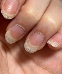 描いた線が汚い、荒い、ギザギザして見えます - CLIP STUDIO 公式サポート