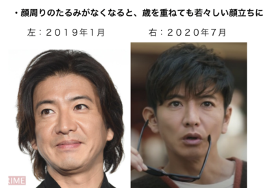 顔のシワやたるみが気になる。見た目への意識が高まる40代、50代男性。中年層のエイジングケア「肌の再生医療」、10年で男性患者数約4倍に増加。 |  株式会社セルバンクのプレスリリース