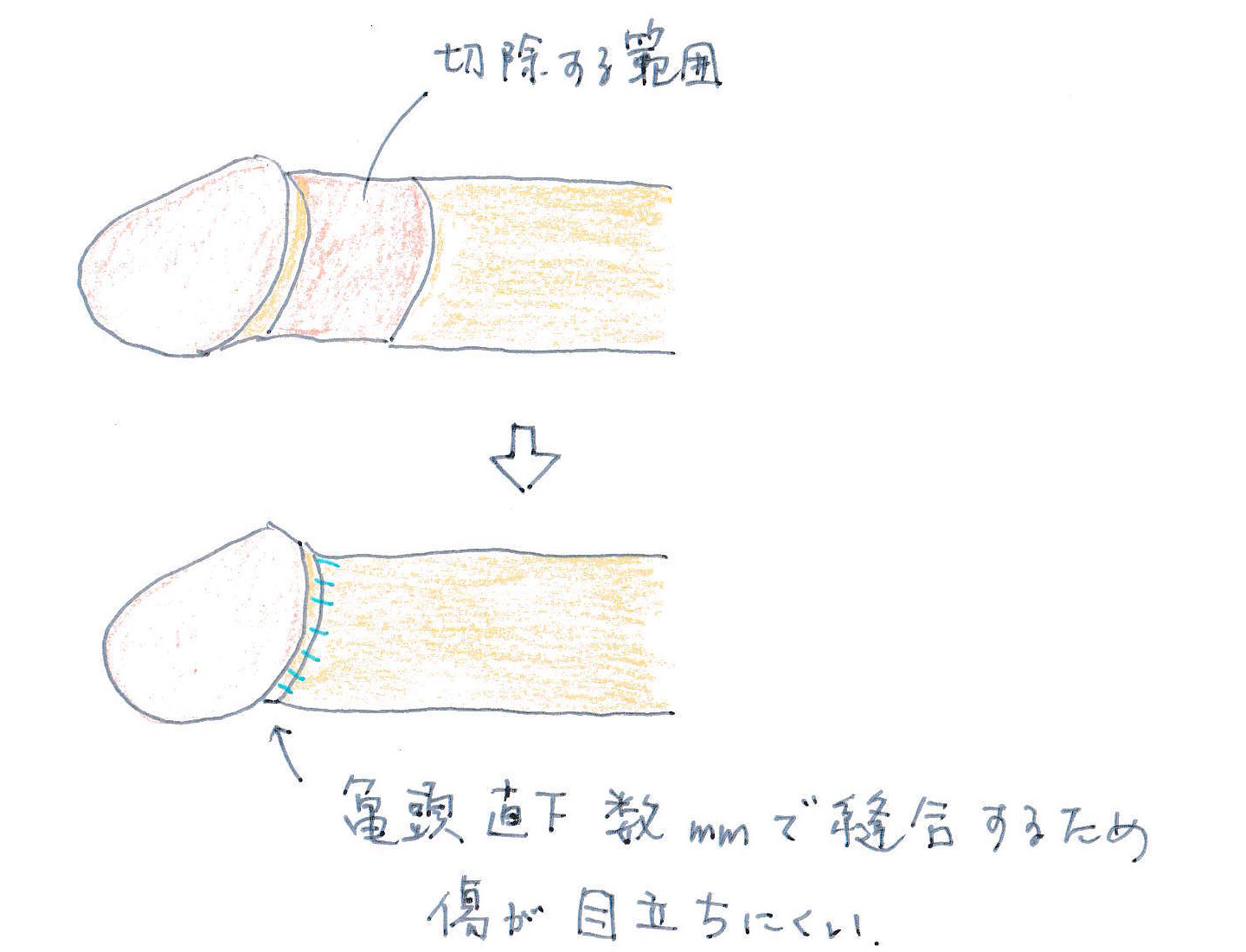 乳不巨何以聚人心胸不貧何以平天下 - 請標記你那個不能畢業的朋友 ハロー!こんにゃく