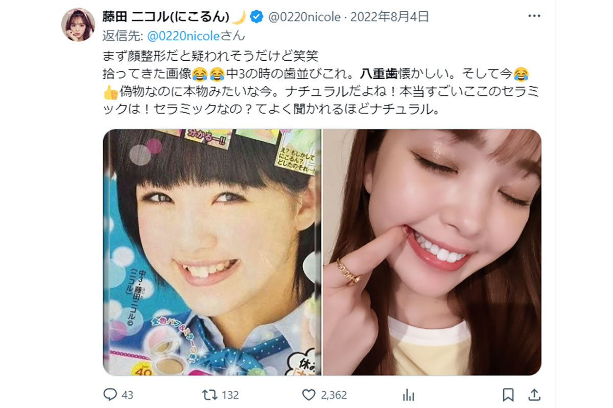 板野友美さんの歯並びの変化について解説【セラミック矯正・歯科医監修】