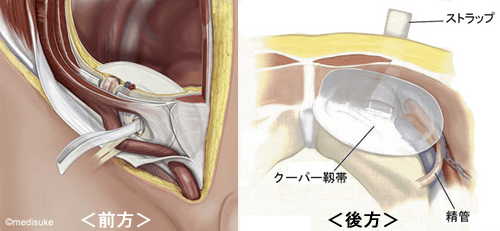 去勢手術で予防できる【精巣腫瘍】について｜茨城県つくば市のうめぞの動物病院 | 避妊・去勢手術 | 