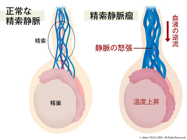 サケの一生 サケの人口授精6