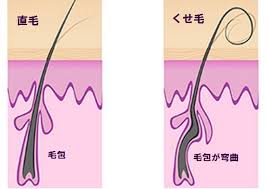 神奈川県・横浜】メンズVIO脱毛(男のケツ毛・ちん毛)できるサロン・クリニック比較！｜男セイケツ.com