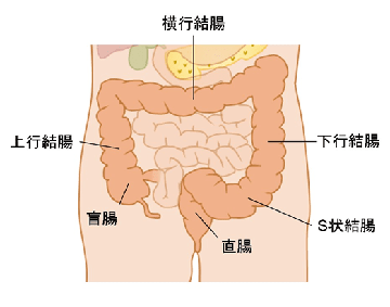 S状結腸軸捻転症｜オリンパス おなかの健康ドットコム