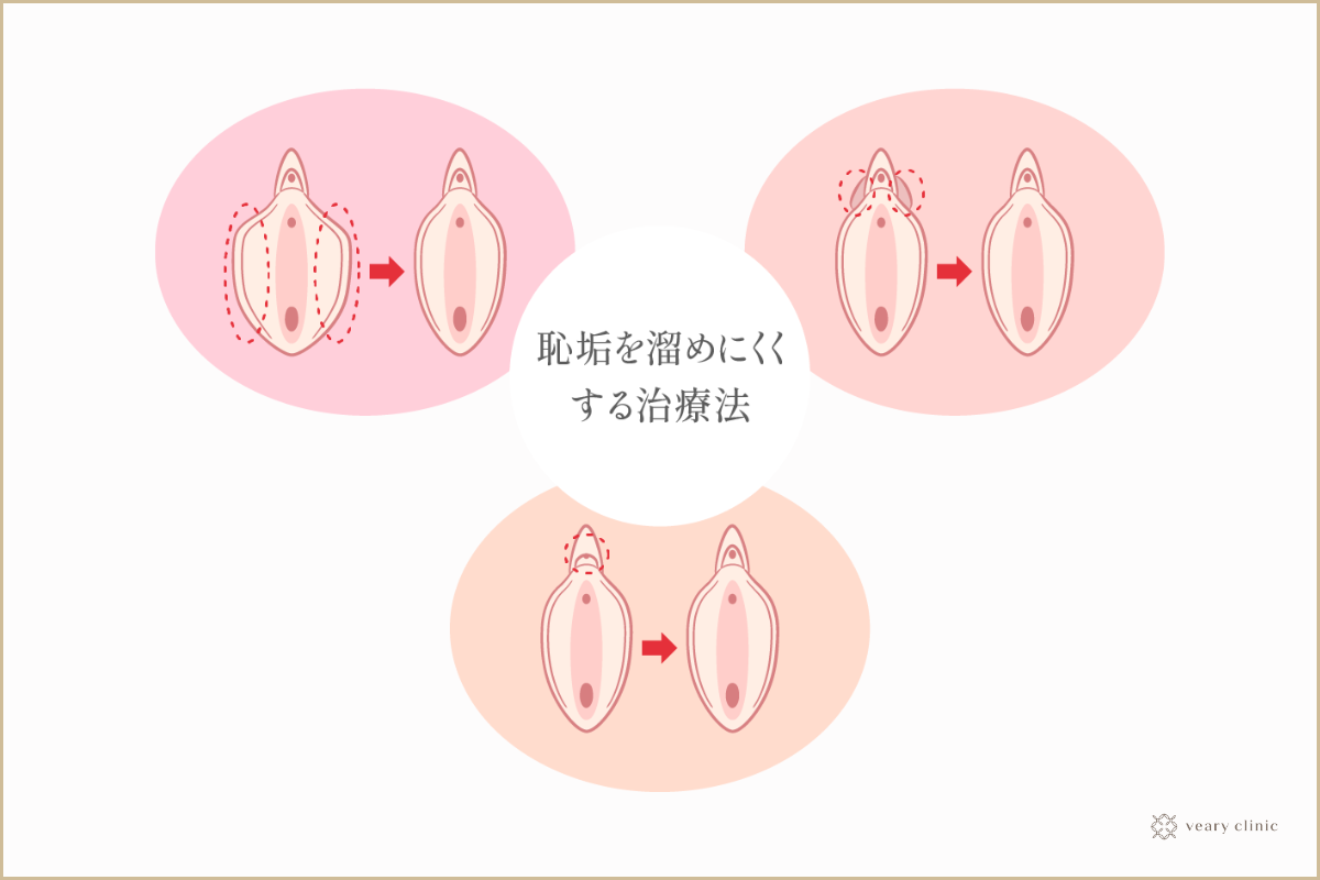 男性必見！クリトリスの皮は剥くべきか？徹底的に考えてみた