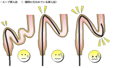 Ｓ状結腸開発調教 １ – アダルト官能小説 快楽機姦研究所