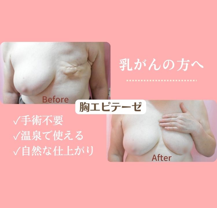 恥ずかしい乳毛はなぜ生える？正しいケアの方法とは | エピテーゼ専門サロン『エピテみやび』完全オーダーメイド