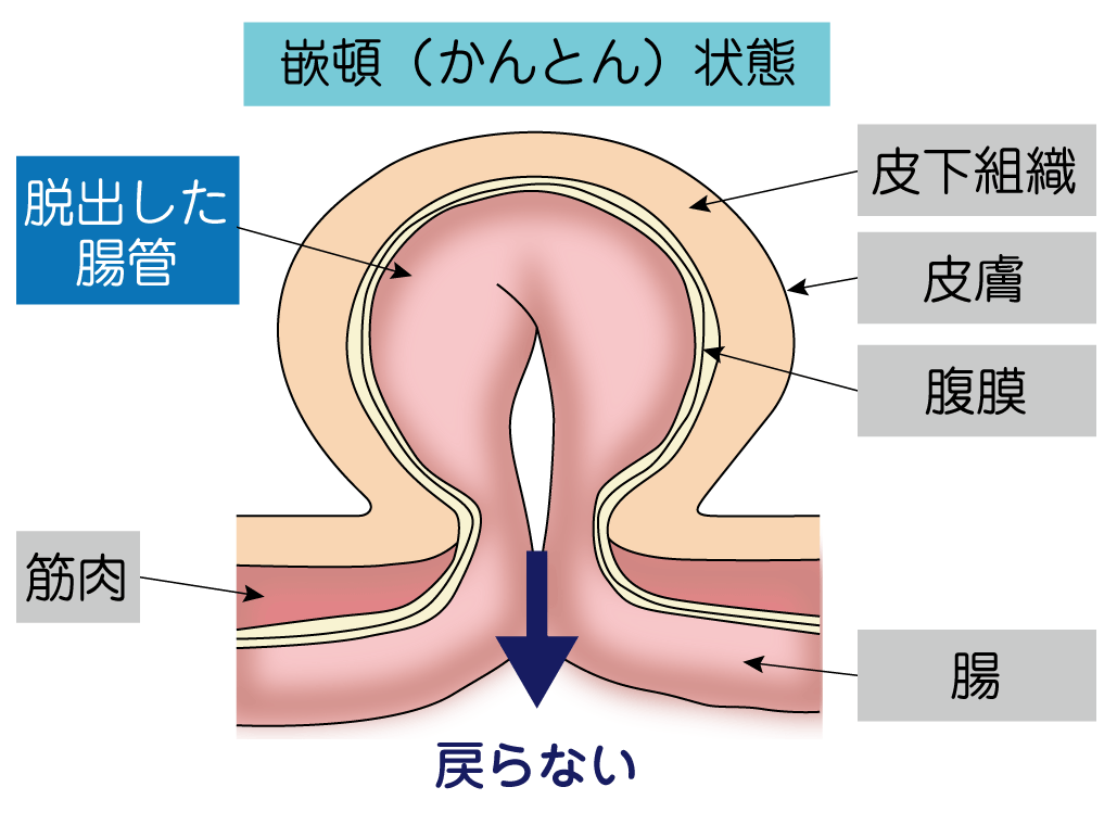 2024年】関東エリアの鼠径ヘルニア治療 おすすめしたい6医院 | メディカルドック