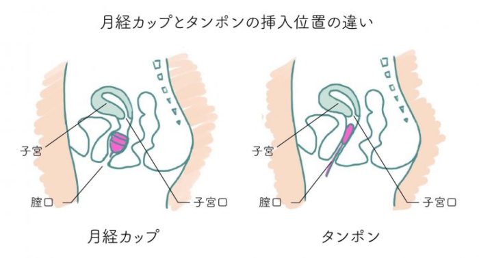 風俗でプレイ中に生理が来たらどうすればいい？対処方法は？ | FQSS