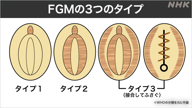 帯広中央クリニック｜婦人科形成専門クリニック｜女性器について