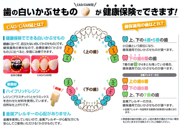 セラミック矯正とは？メリット・デメリット｜まつもと歯科 よくあるご質問