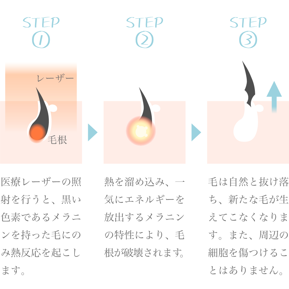 ヒゲが濃い原因とは？薄くする方法を徹底解説 | レーザースキンクリニック