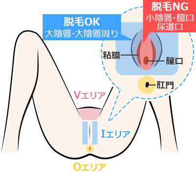 ハイジニーナ、パイパンとは？後悔とやり方 - 夜の保健室