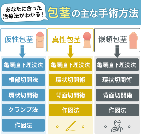 包茎手術 | 東京美専クリニック